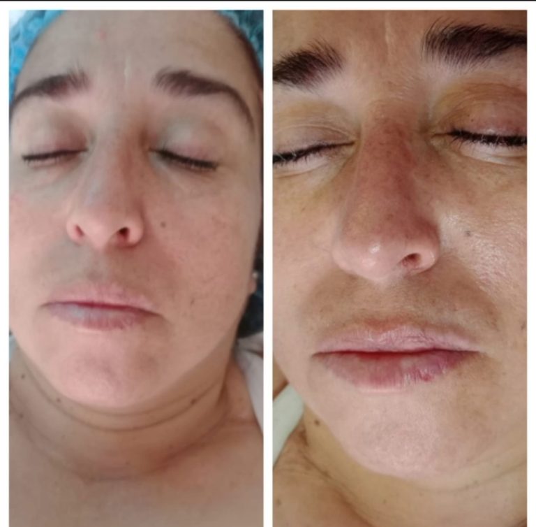 Angelica Masoterapia 768x754